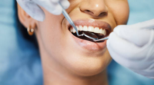 Best Chipped Tooth Repair Near Me  in Wyoming, DE